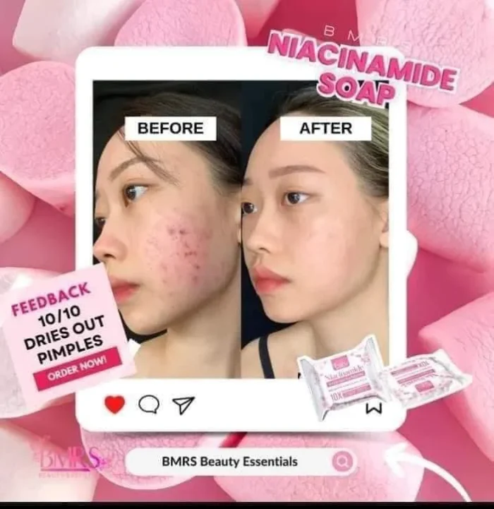 BMRS Niacinamide Soap 10x Whitening With Glutathione - 70g - Image 2