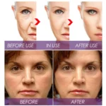 venature Bakuchiol Retinol Rejuvenation Serum - 30ml - Image 6