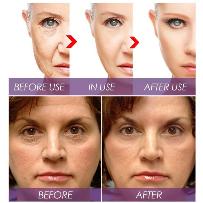 Venature Bakuchiol Retinol Rejuvenation Serum - 30ml - Image 6