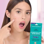 Luxe Organix Hydrocolloid Acne Patch – Night Time (48 Patches) - Image 3