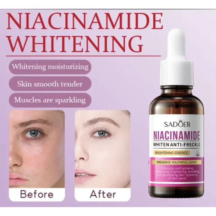 Sadoer Niacinamide Whiten Anti-Freckle Brightening Essence – 30ml - Image 2