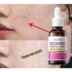 Sadoer Niacinamide Whiten Anti-Freckle Brightening Essence – 30ml - Image 3