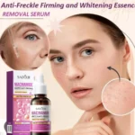 Sadoer Niacinamide Whiten Anti-Freckle Brightening Essence – 30ml - Image 4